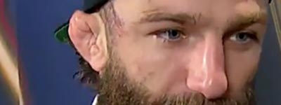 Michael Chiesa UFC interview after a fight.