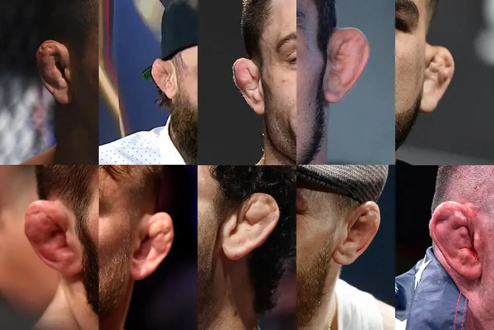 The 10 Worst Cauliflower Ear Ufc Fighters In 2021 Fightnomads Combat Sports Life Blog